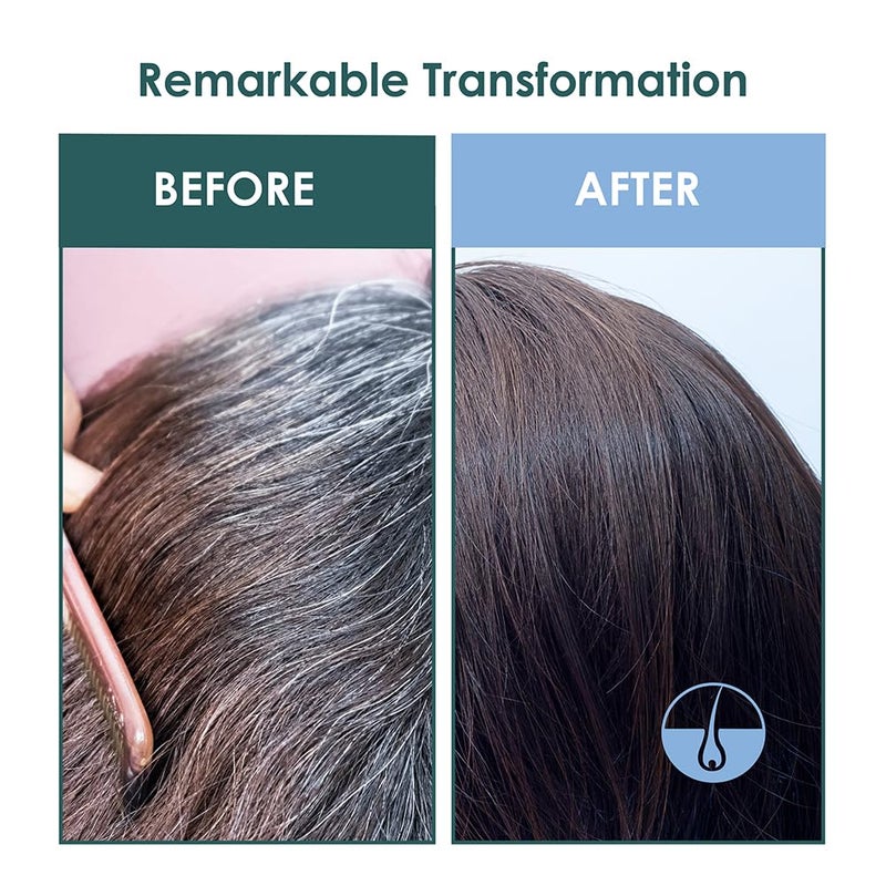 Sh Rd SH-RD Intensive Scalp Essence for Anti-Aging | Promotes Hair Growth with Amino Acids, Protein, Vitamin B5 | Lightweight Serum - 50ml/1.69oz - Image 4